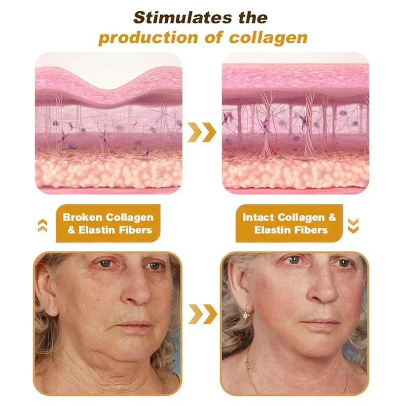 Botox Bee Venom Wrinkle Remover Cream (Buy 1 Get 1 Free)